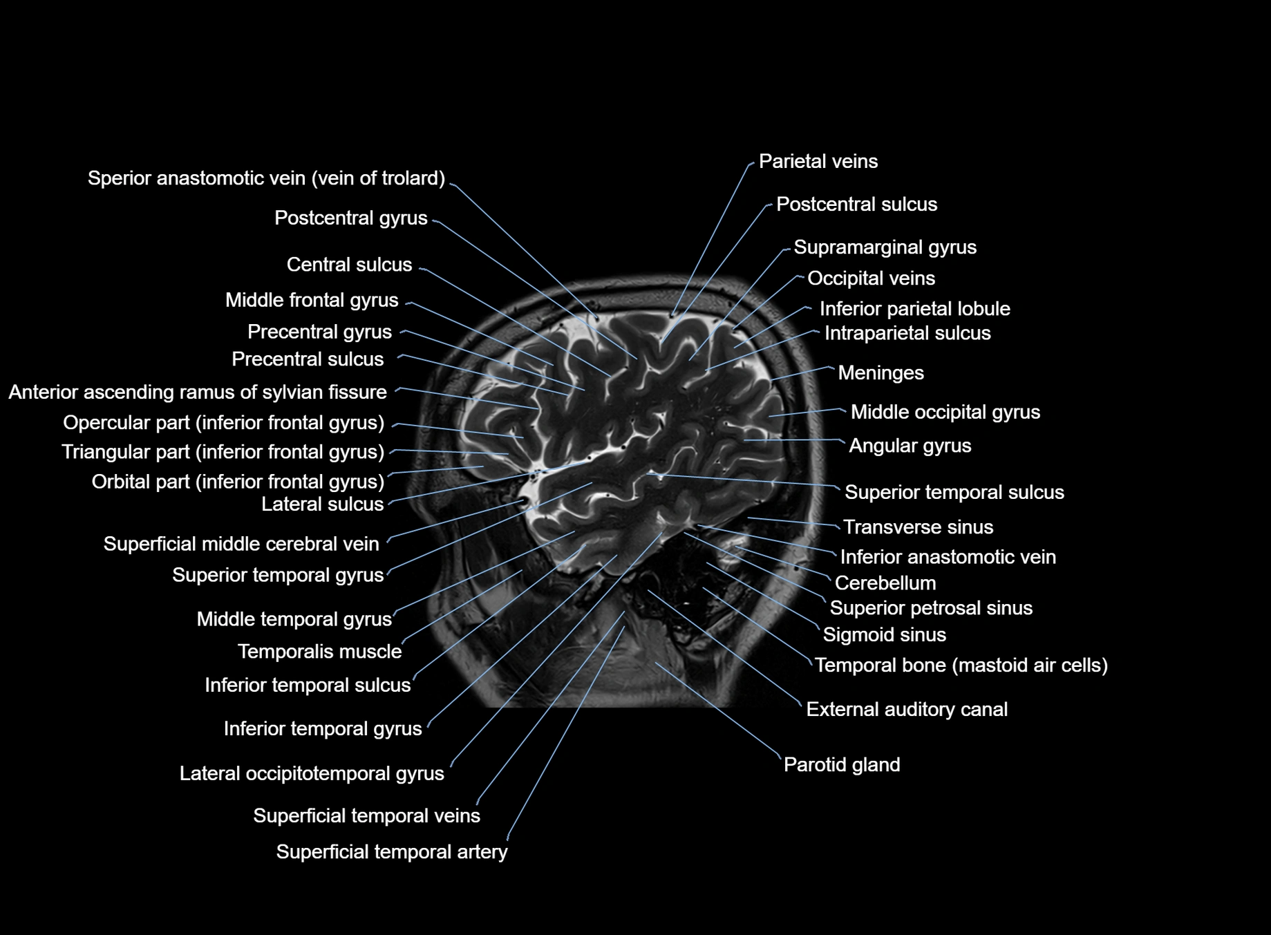 brain sagittal anatomy 3T MRI images -img-00001-00012.webp